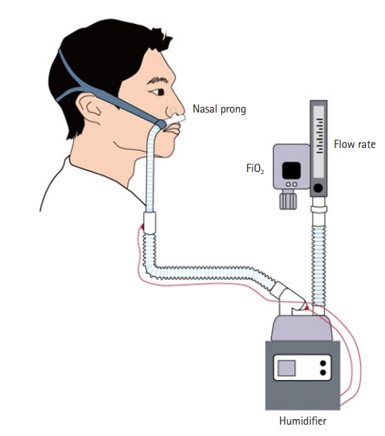 High flow nasal cannula